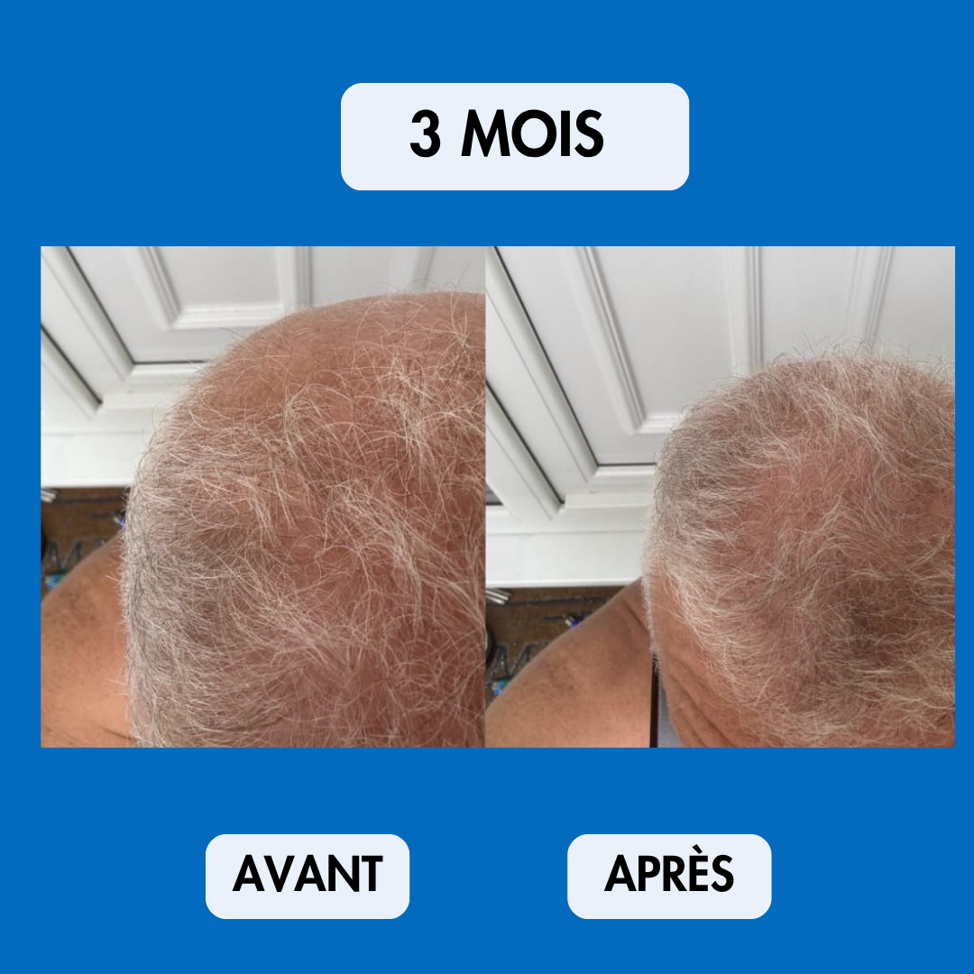 Sérum Repousse Sans Effets Secondaires – Nalhaa