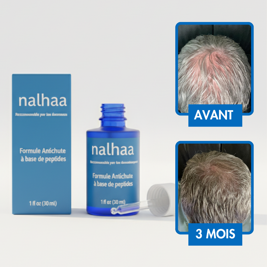 Sérum Repousse Sans Effets Secondaires – Nalhaa