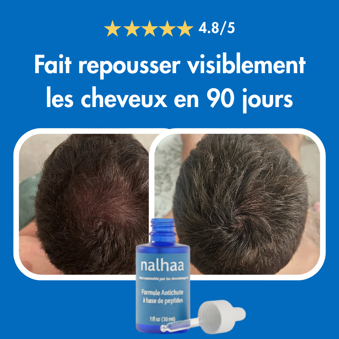 Sérum Repousse Sans Effets Secondaires – Nalhaa