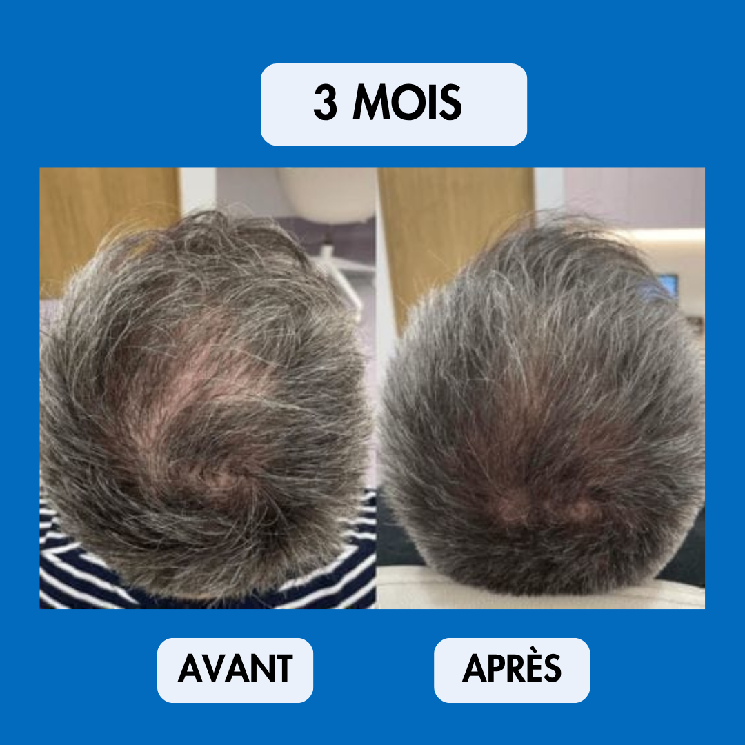 Sérum Repousse Sans Effets Secondaires – Nalhaa