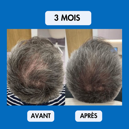 Sérum Repousse Sans Effets Secondaires – Nalhaa