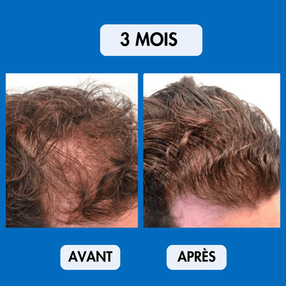 Sérum Repousse Sans Effets Secondaires – Nalhaa