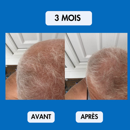 Sérum Repousse Sans Effets Secondaires – Nalhaa